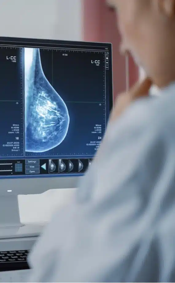 A medical professional examines a breast X-ray or mammogram displayed on a computer screen, focusing on the detailed scan image for analysis or diagnosis.